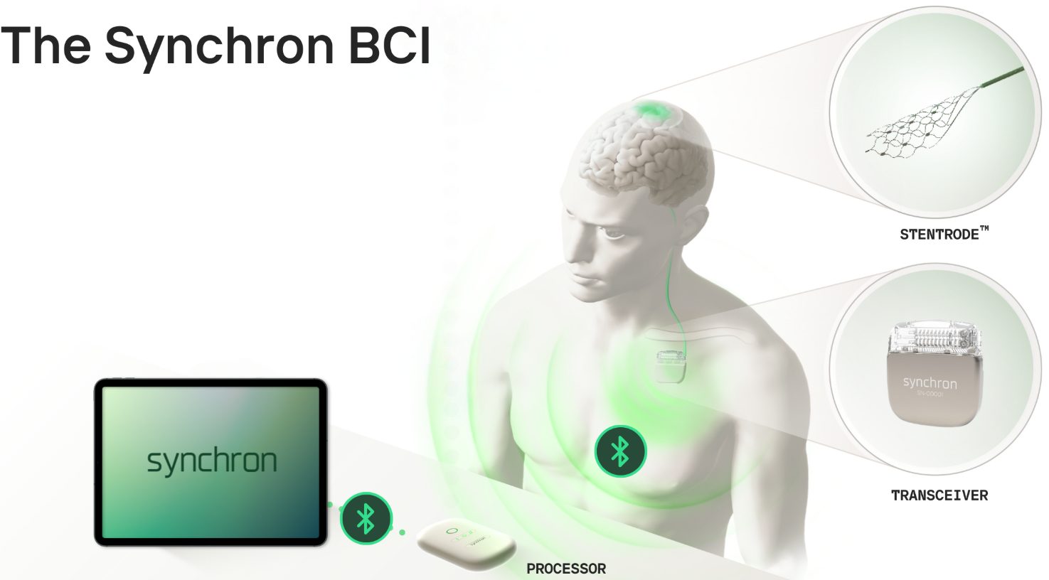SynchronBCI